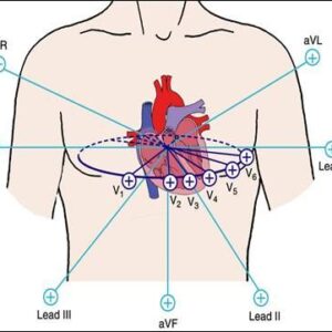 Electrocardiogram (ECG)